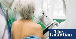 ‘Feminist approach’ to cancer could save lives of 800,000 women a year